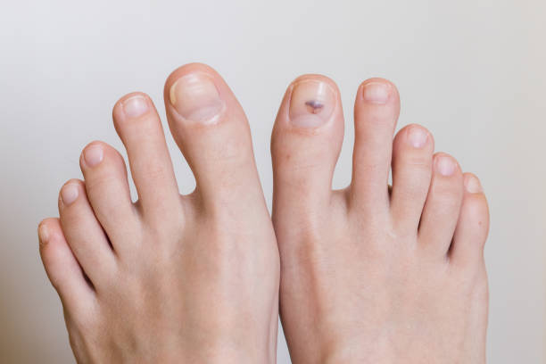 Foot & Nail Care