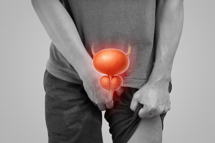 Men’s Prostate Wellness