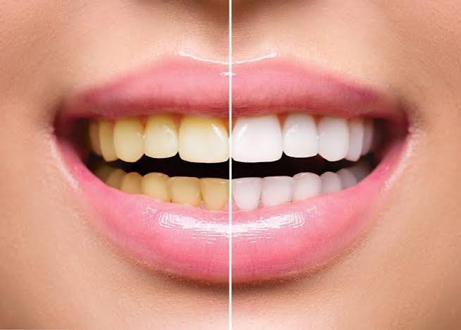 6 Simple Ways to Improve Your Night Brushing